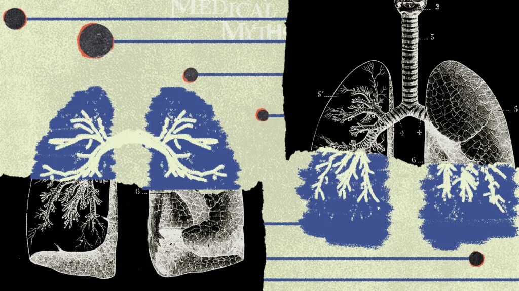 Medical myths logo with lung scan imagery