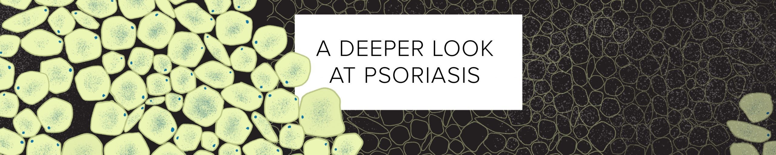A Deeper Look at Psoriasis